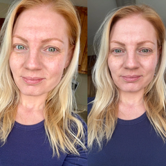 My skin finally feels calm